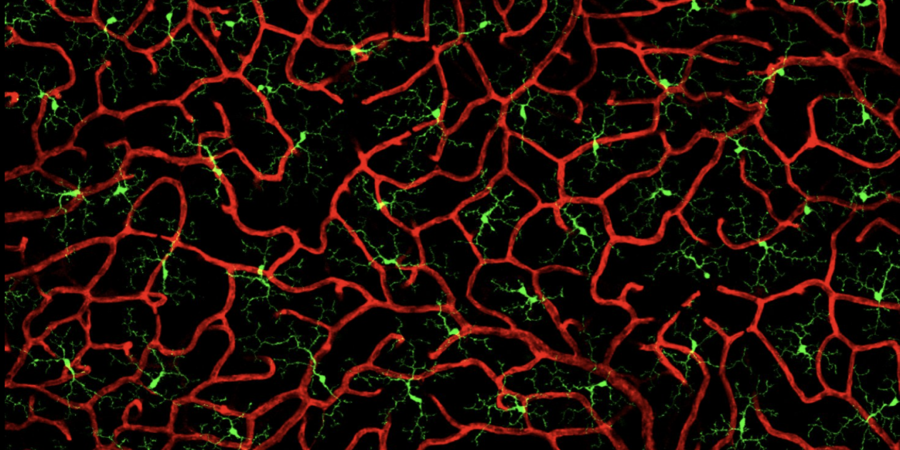 Fundamentals of Fluorescence Microscopy / Events